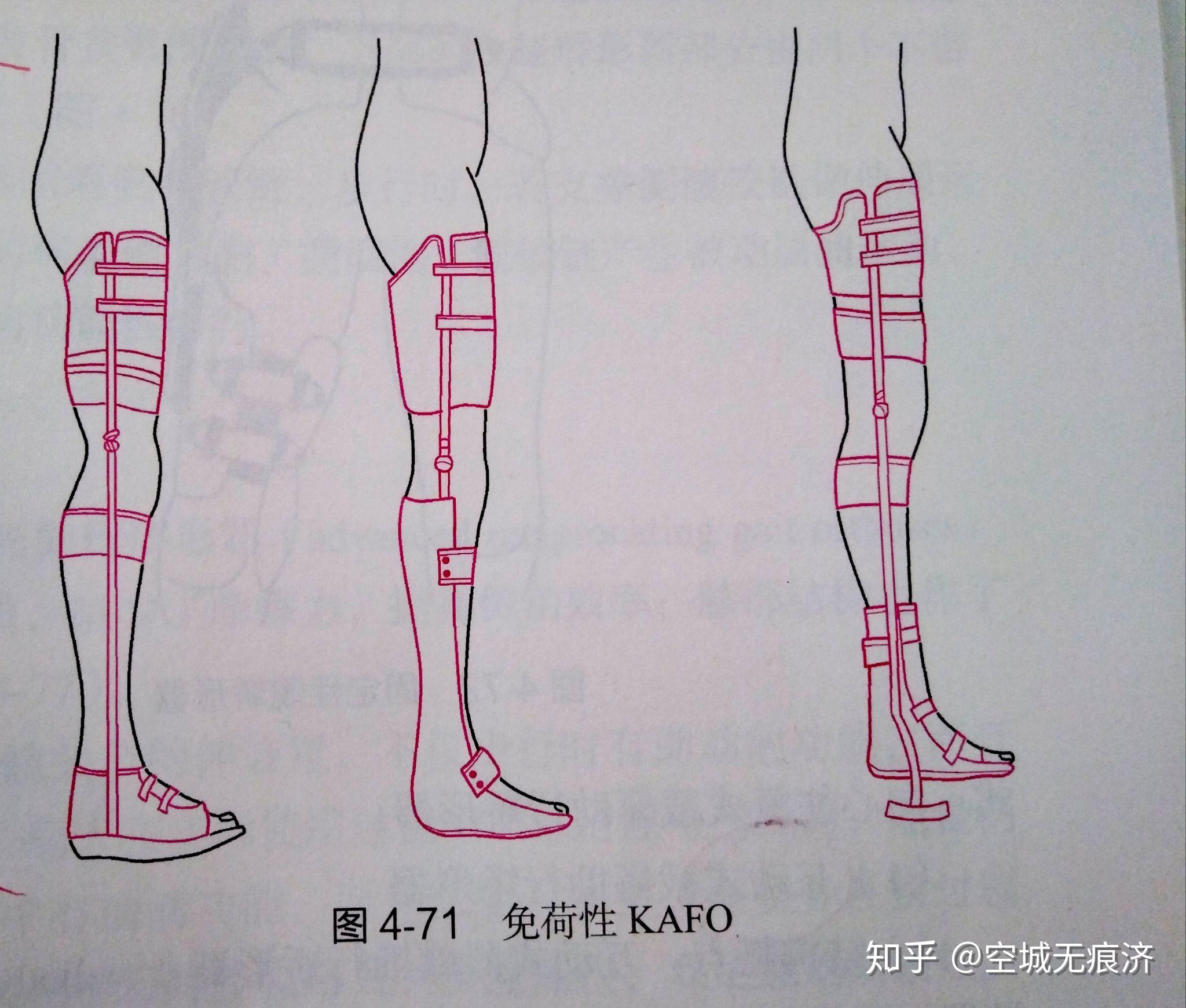 臨床康復工程學 假肢與矯形器的功能、設(shè)計與發(fā)展